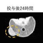 単一高分子の「自己折りたたみ」に基づく新規MRI造影剤を開発